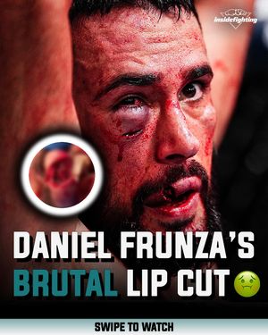 Image post by @insidefighting on Instagram
