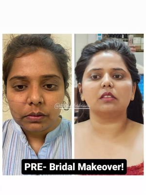 Image post by @nikkybawamedisalonbhopal on Instagram