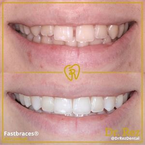 Image post by @drrezdental on Facebook
