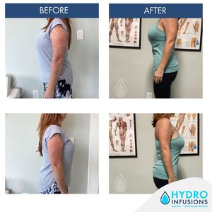 Image post by @hydromedspa on Facebook