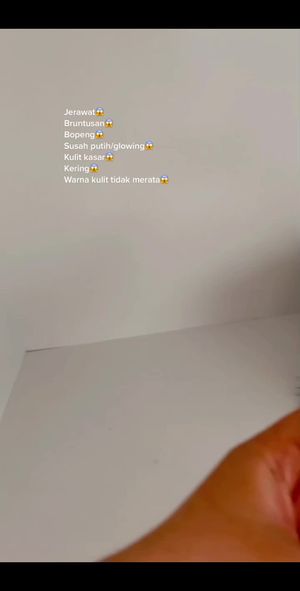 Video post by @lili.refliskin on TikTok