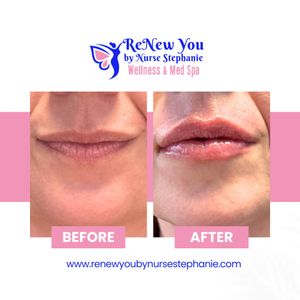 Image post by @renewyoubynursestephanie on Instagram
