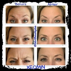 Image post by @hydromedspa on Facebook
