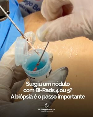 Image post by @drdiegobezerra on Instagram
