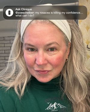 Image post by @clinique on Instagram