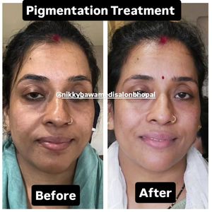 Image post by @nikkybawamedisalonbhopal on Instagram