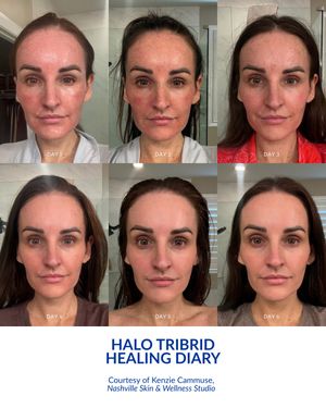 Image post by @sciton_inc on Instagram