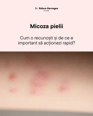Image post by @dr.ralucaharnagea on Instagram
