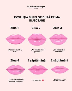 Image post by @dr.ralucaharnagea on Instagram