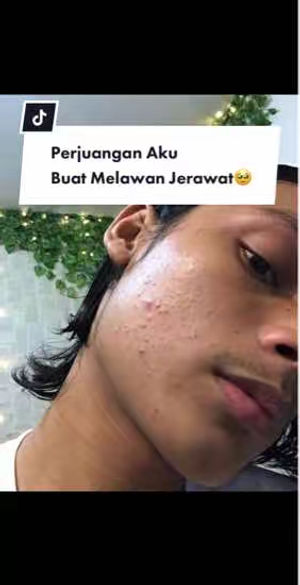 Image post by @beningsclinicindonesia on TikTok