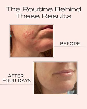 Image post by @stacichristieskin on Instagram