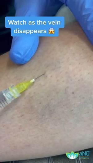 Video post by @anuaestheticsandwellness on Instagram