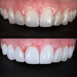 Image post by @fahaddentist on Instagram