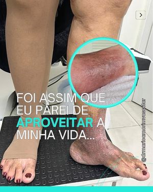 Image post by @drmarioamorimvascular on Instagram