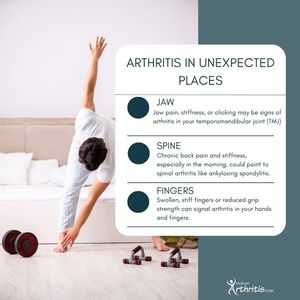 Image post by @PiedmontArthritisClinic on Facebook