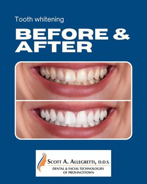 Image post by @DentalandFacialTechnologiesofProvincetown on Facebook