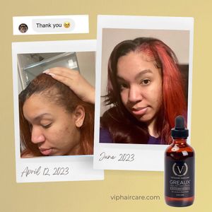 Image post by @vipluxuryhaircare on Instagram