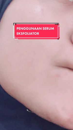 Video post by @lili.refliskin on TikTok