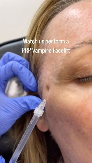 Video post by @anuaestheticsandwellness on Instagram