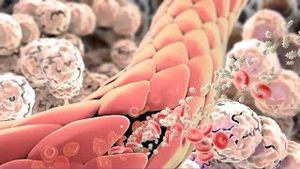 Video post by @nucleusmedicalmedia on YouTube