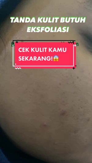 Video post by @lili.refliskin on TikTok