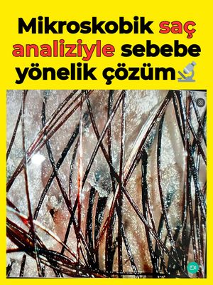 Image post by @drozlemteberik on Instagram