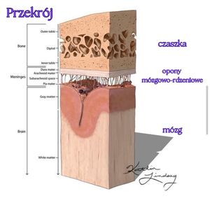 Image post by @neurochirurg_litak on Instagram