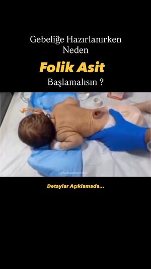 Video post by @ebe.hanimmmm on Instagram