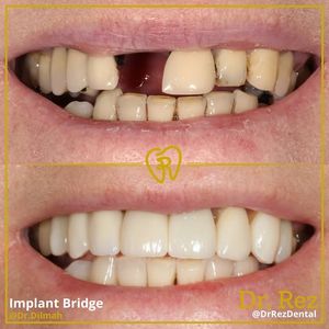 Image post by @drrezdental on Facebook