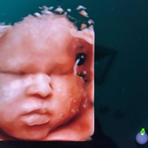 Image post by @dr.aliriogrisanti on Instagram