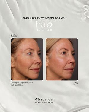 Image post by @sciton_inc on Instagram