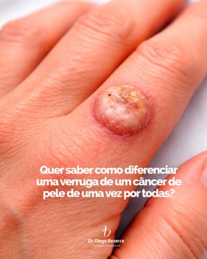 Image post by @drdiegobezerra on Instagram