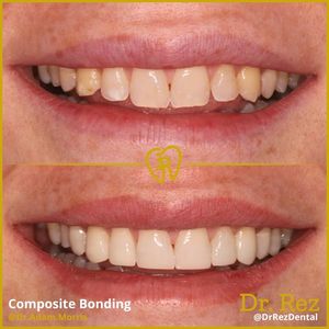 Image post by @drrezdental on Facebook