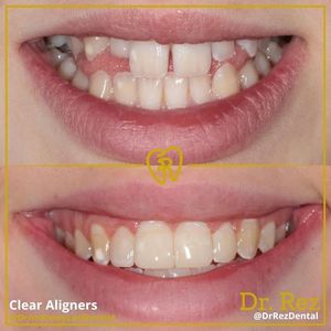 Image post by @drrezdental on Facebook