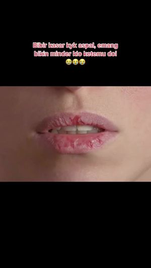 Video post by @lili.refliskin on TikTok