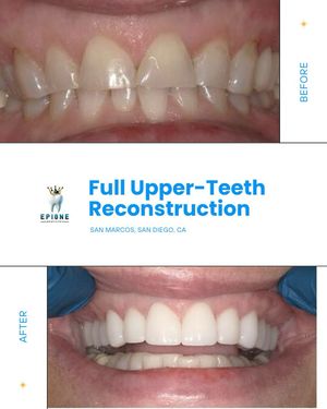 Image post by @epione.dentistry on Instagram