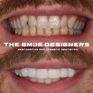 Image post by @fahaddentist on Instagram