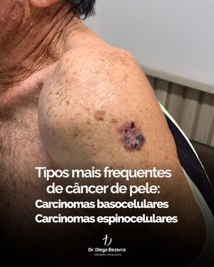 Image post by @drdiegobezerra on Instagram