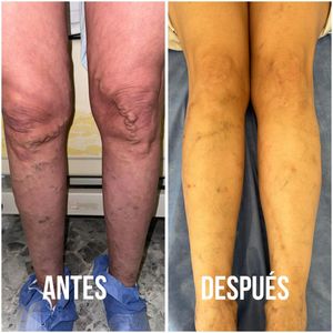 Image post by @dr.vicentevascular on Instagram