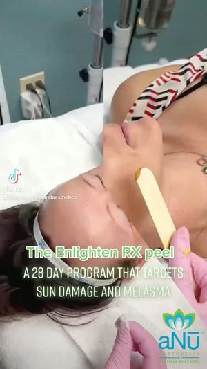 Video post by @anuaestheticsandwellness on Instagram