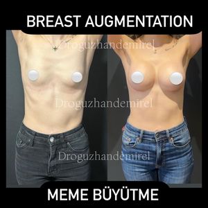 Image post by @droguzhandemirel on Instagram