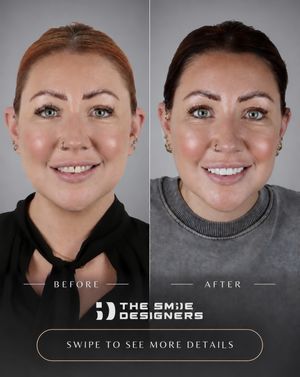 Image post by @fahaddentist on Instagram