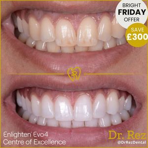 Image post by @drrezdental on Facebook