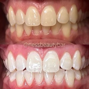 Image post by @HessBeautyBar on Facebook