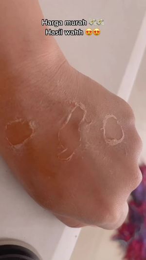 Video post by @lili.refliskin on TikTok