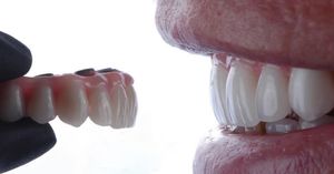 Image post by @sharpdentistry on Instagram