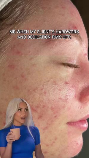 Video post by @HessBeautyBar on Facebook