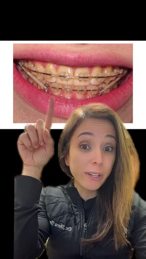 Video post by @weisstorortho on TikTok