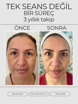 Image post by @drozlemteberik on Instagram