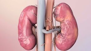 Video post by @nucleusmedicalmedia on YouTube